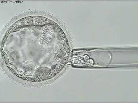blastocyst biopsy